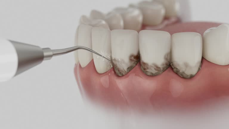 Reliable Dental Implants contractor in Cresskill, NJ by Smile Center Dentistry